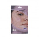 Isntree Onion Newpair Spot Patch thumbnail